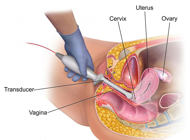 Hizmetler - Vaginaler Ultraschall