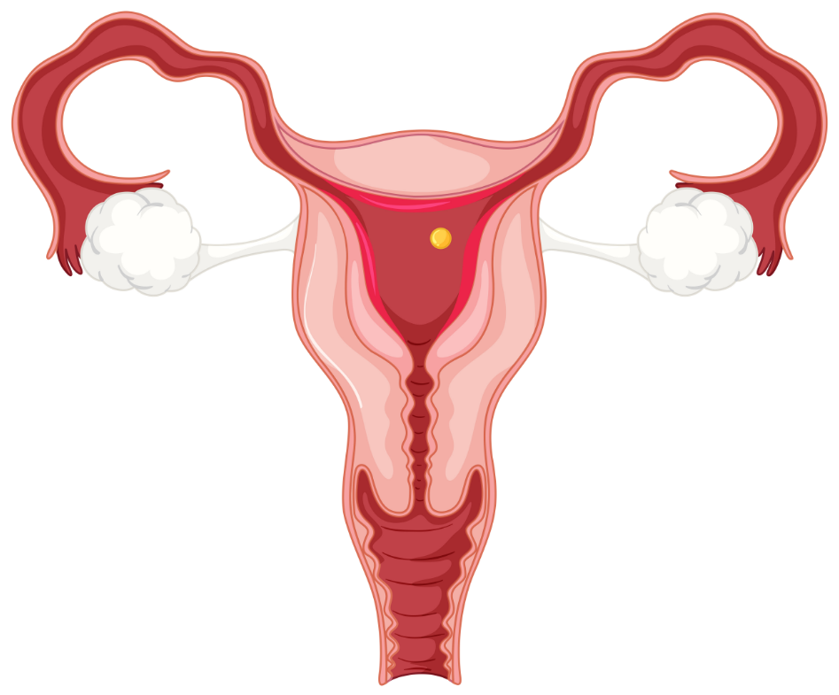 Hizmetler - Intrauterine Biopsie